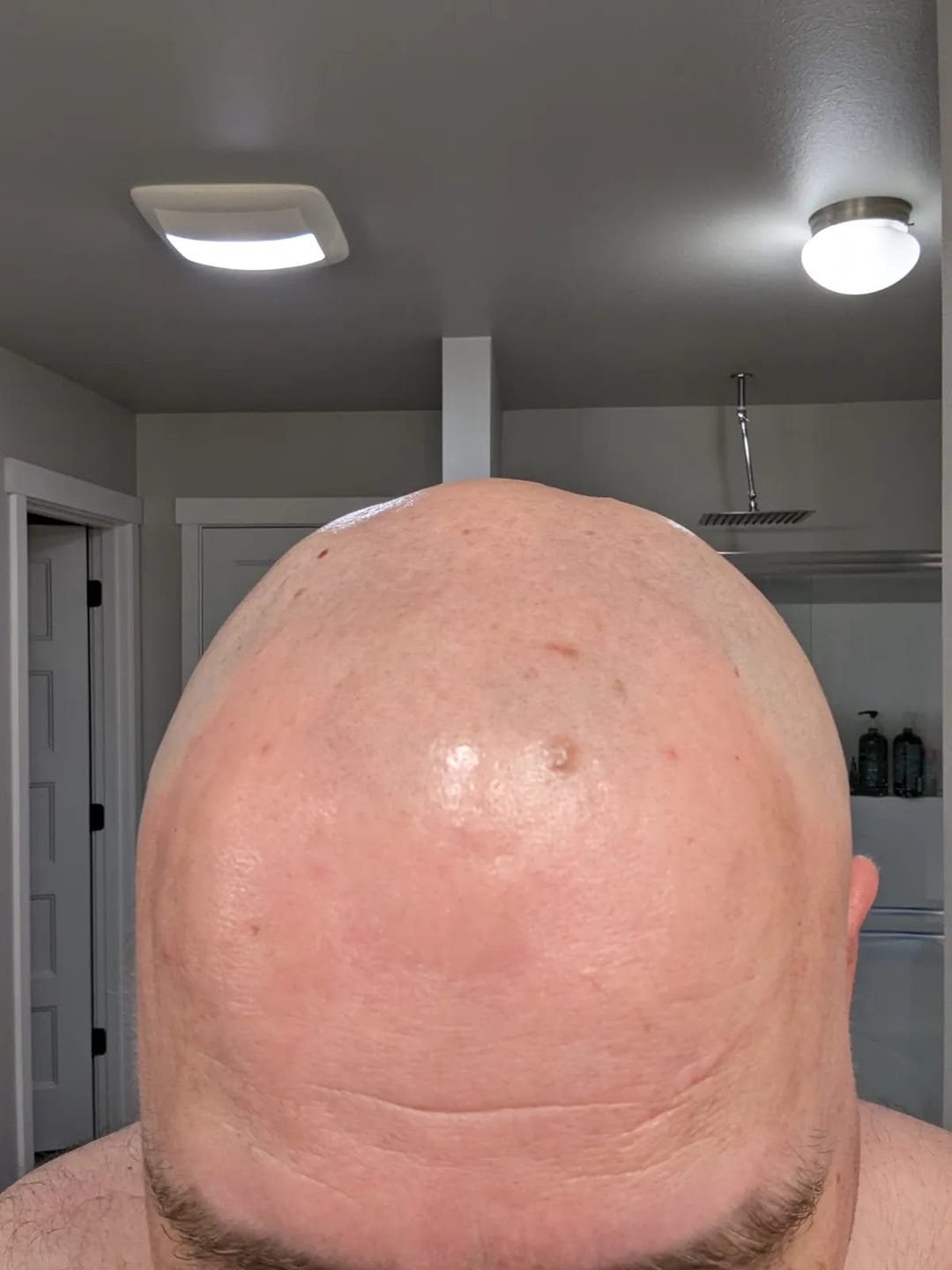 Customer photo review of Hair Removal Cream Made for face + scalp