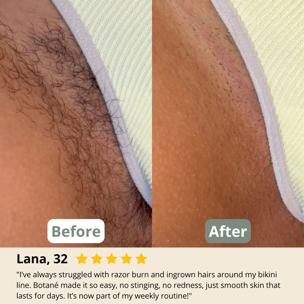 Verdane Woman - Hair Removal Cream